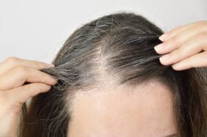 Hair Loss Treatment in Mirage, CA | Palm Springs, CA | Viviscal Hair Loss Treatment in Mirage, CA | Palm Springs, CA | Viviscal