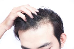 Viviscal Professional Hair Loss Treatment