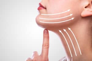 kybella facial rejuvenation