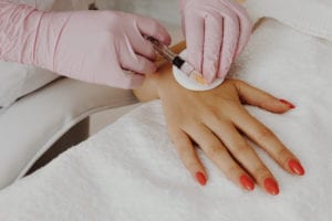 An image of a hand that is receiving a dermal filler injection for hand rejuvenation