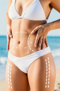 Renuvion™ Skin Tightening Rancho Mirage | Dr. Maria Lombardo