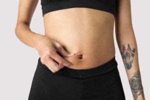woman with a tight stomach from a tummy tuck.