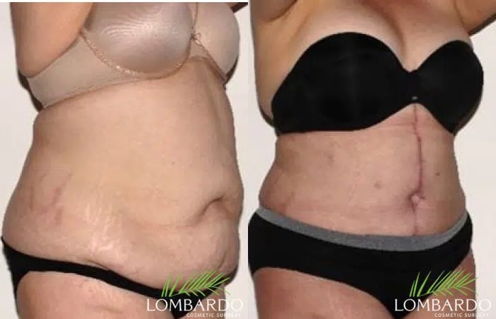Lombardo Cosmetic Surgery | Dr. Maria Lombardo | Rancho Mirage, CA
