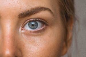 
Chemical Peel
