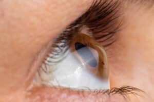 A close-up shot of a woman's eyelashes after Latisse® in Palm Springs