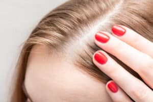 A close-up shot of a woman's thinning hair before Viviscal™ Professional
