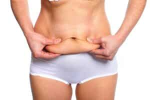 A woman considering a tummy tuck and pinching loose skin after weight loss surgery