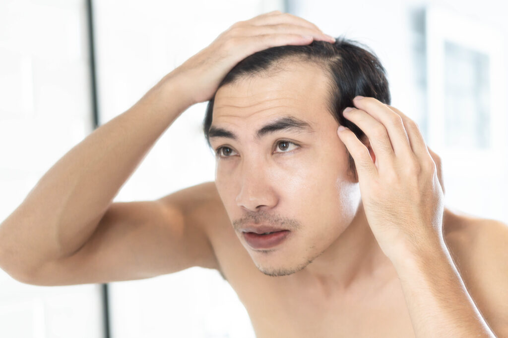 iStock 872693778 A man looking at thinning hair in the mirror before using Viviscal Professional