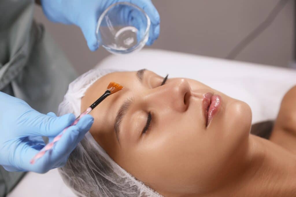 A woman getting a chemical peel in Palm Springs